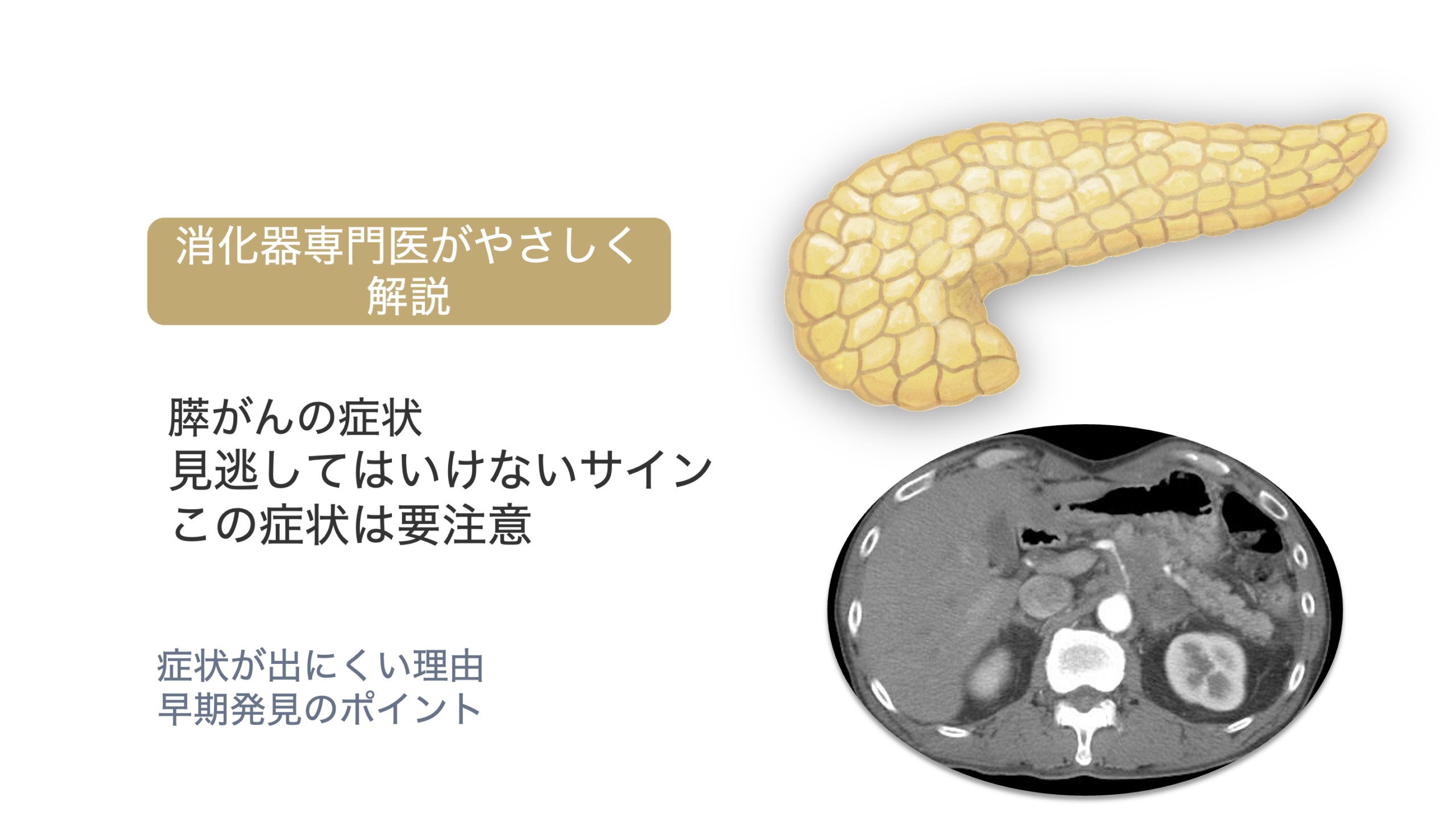 膵がんの症状①｜初期症状から見逃してはいけないサイン