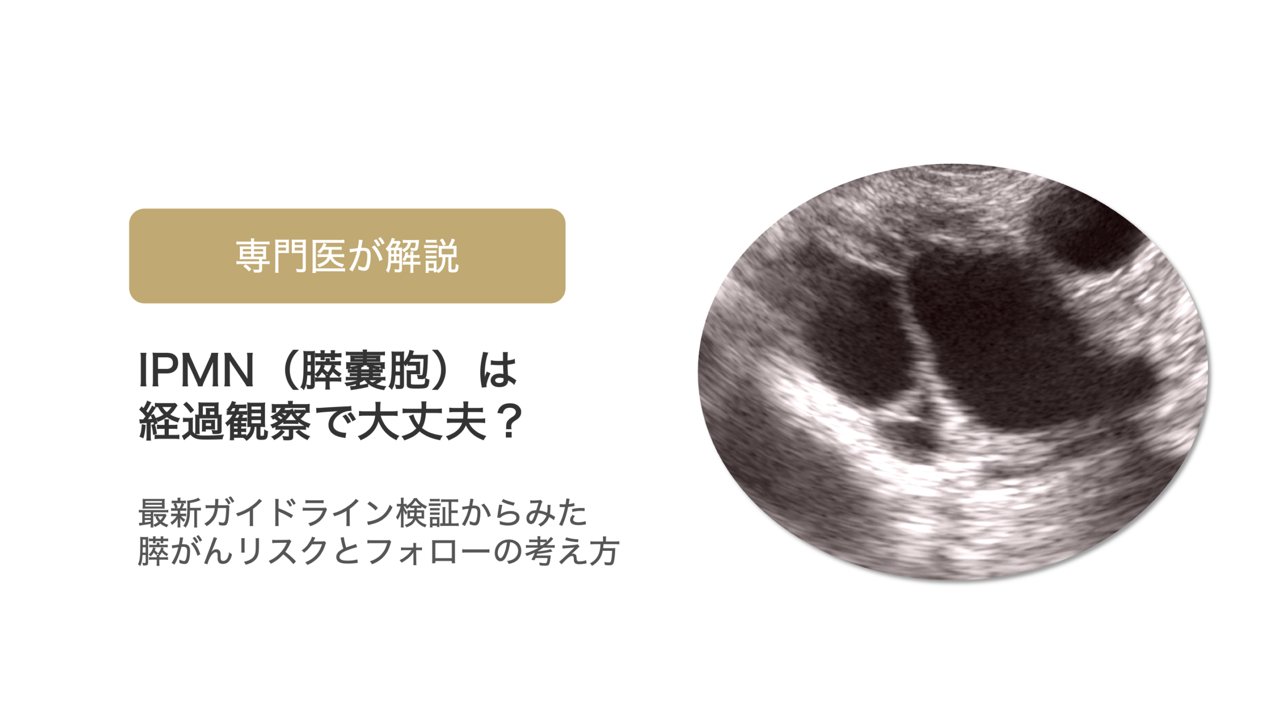 IPMN（膵嚢胞）の最新国際ガイドラインは有効？｜検証研究からみた膵がんリスクと経過観察の考え方