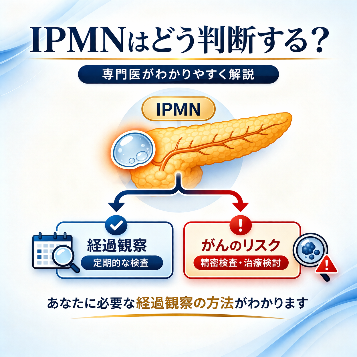 IPMNとは？膵嚢胞との違い・がんとの関係を専門医がわかりやすく解説