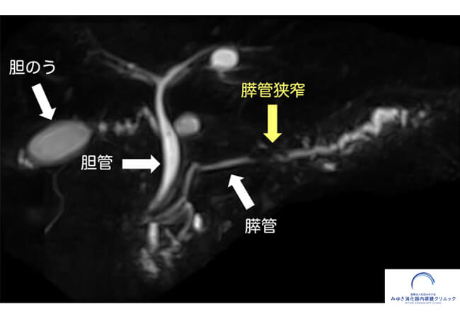 胆のう・胆管・膵臓の画像検査