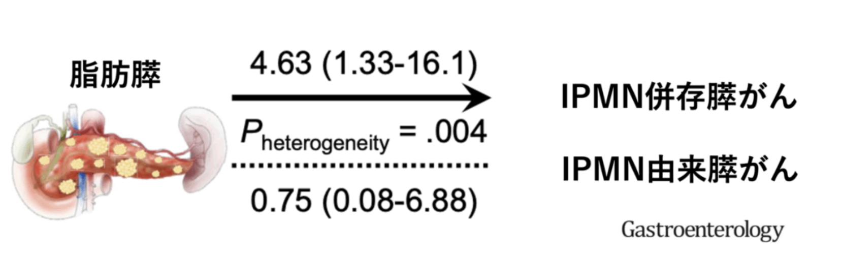 脂肪膵とIPMN関連膵がんリスクを示した論文図（Gastroenterology）