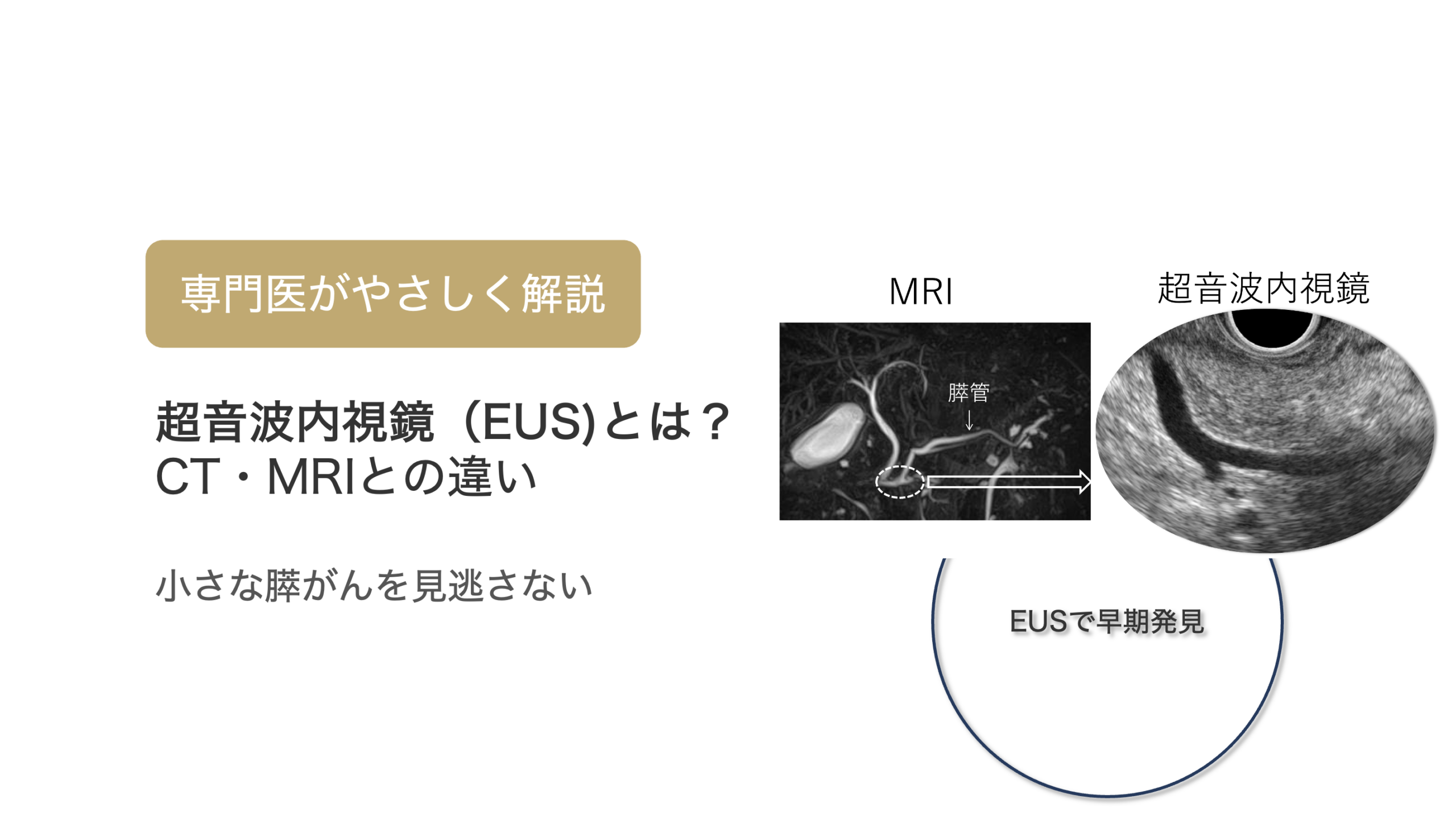 超音波内視鏡（EUS）とは？MRIやCTと何が違うの？