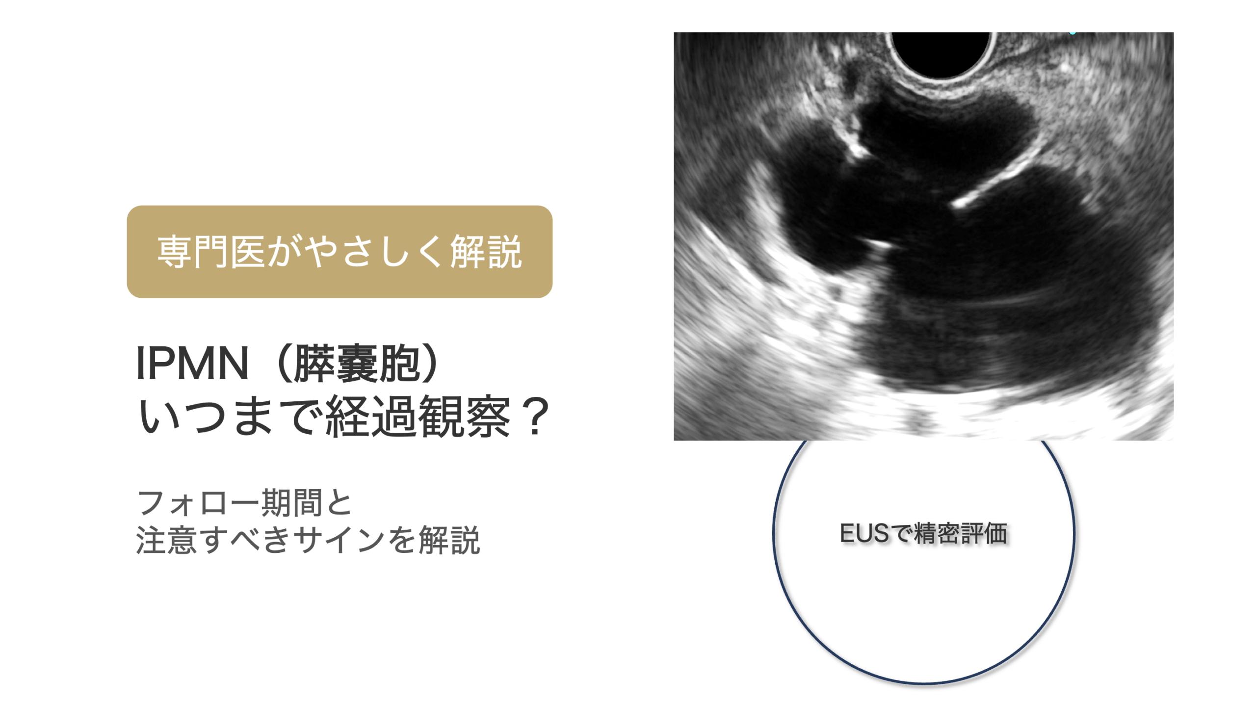 膵管内乳頭粘液性腫瘍はいつまで経過をみるべきか？