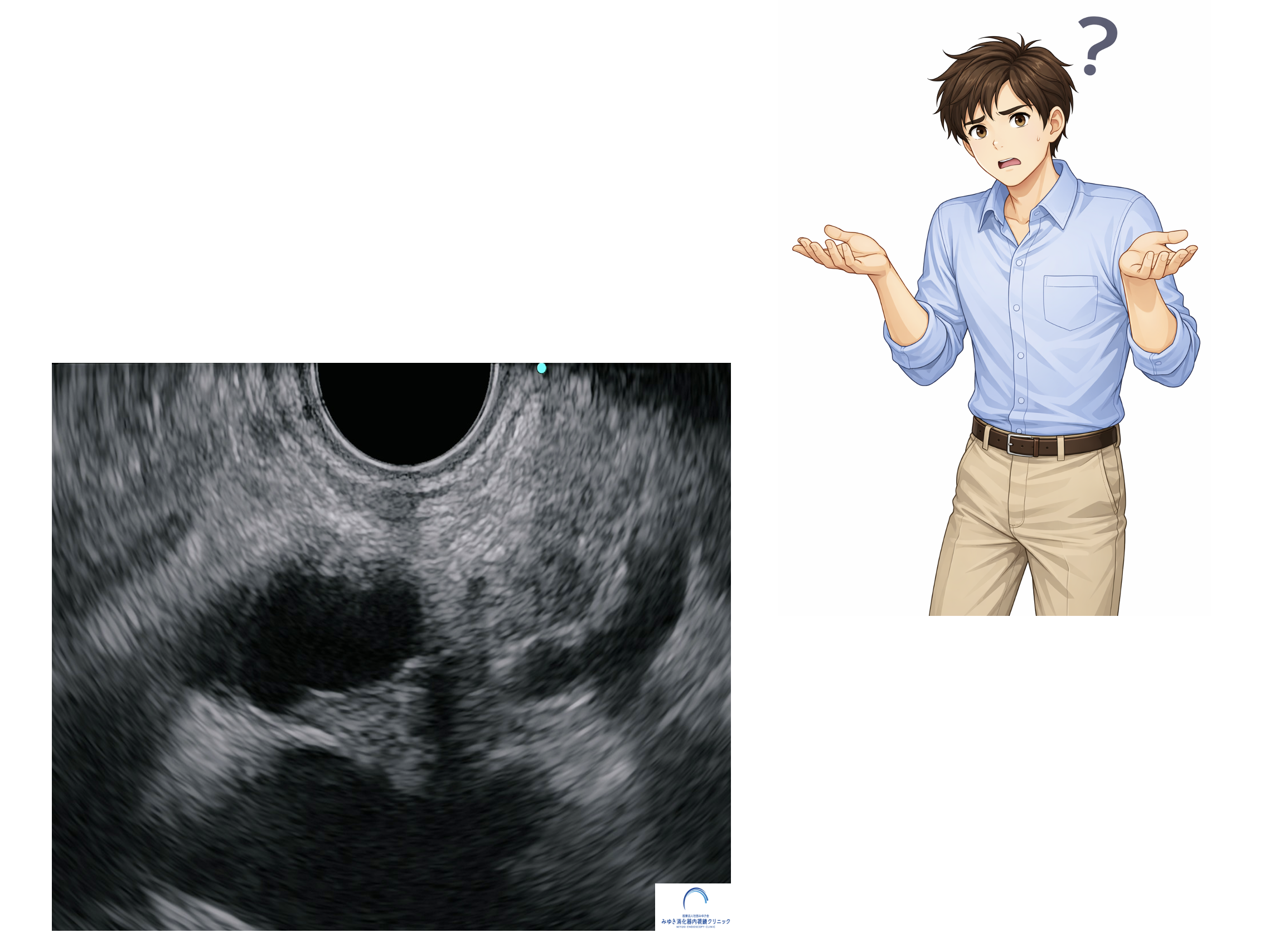 なぜ超音波内視鏡検査（EUS）は習得が難しいのか？