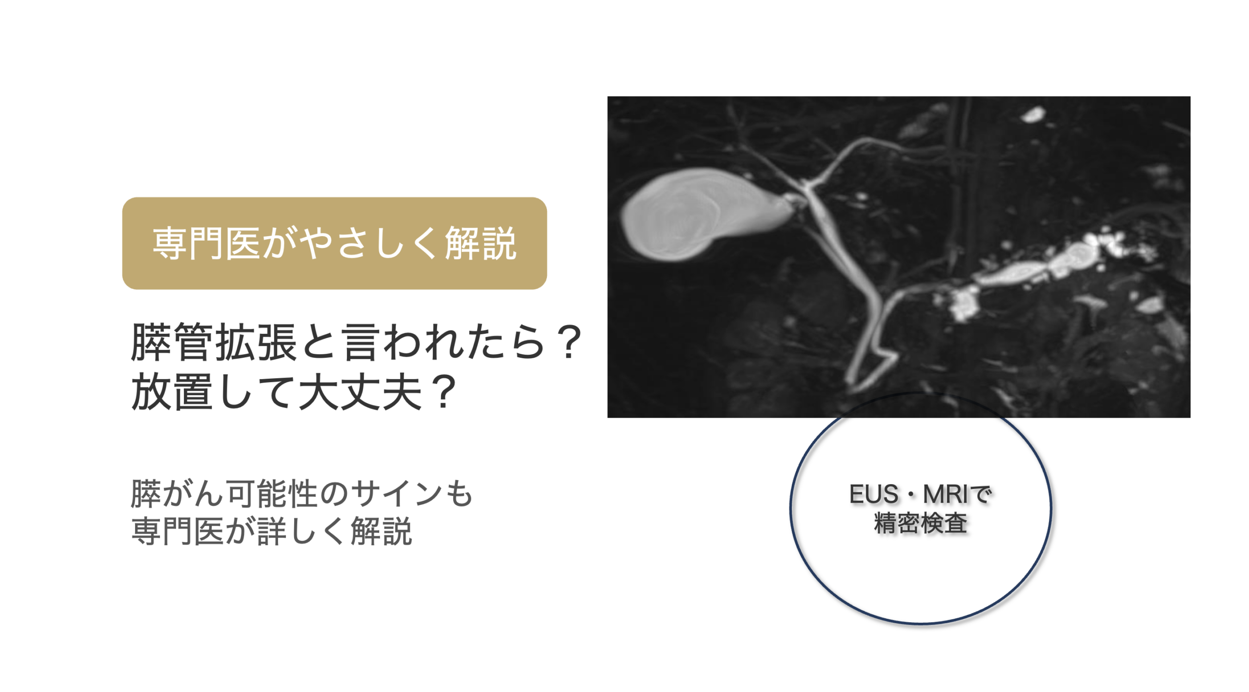 健康診断で「膵管拡張」と言われた方へ｜膵がんの可能性と今すぐ受けるべき検査
