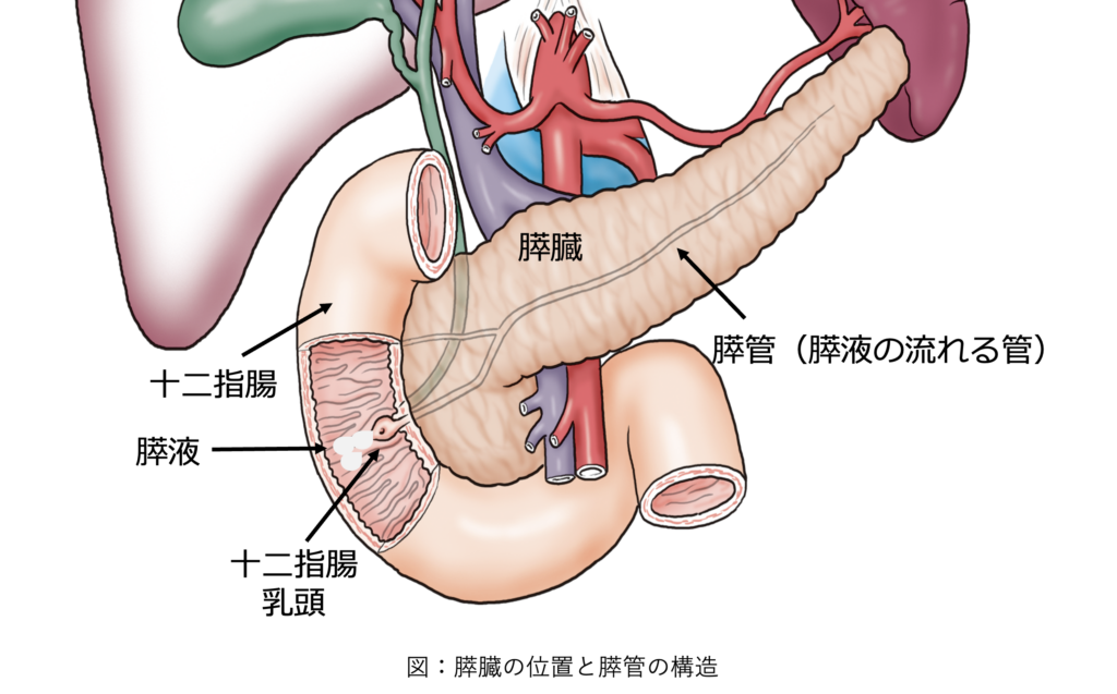 膵管拡張の原因となる膵臓と膵管の構造図|膵がんやIPMNとの関係