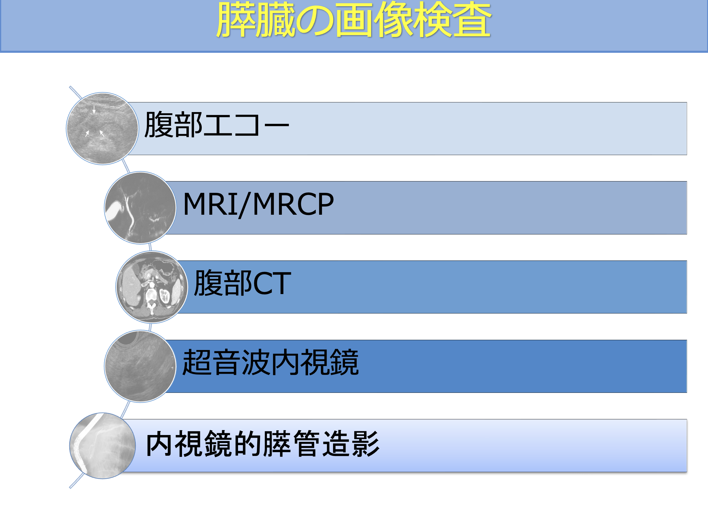 膵臓の主な画像検査（腹部エコー・CT・MRI・EUS）の役割の違い