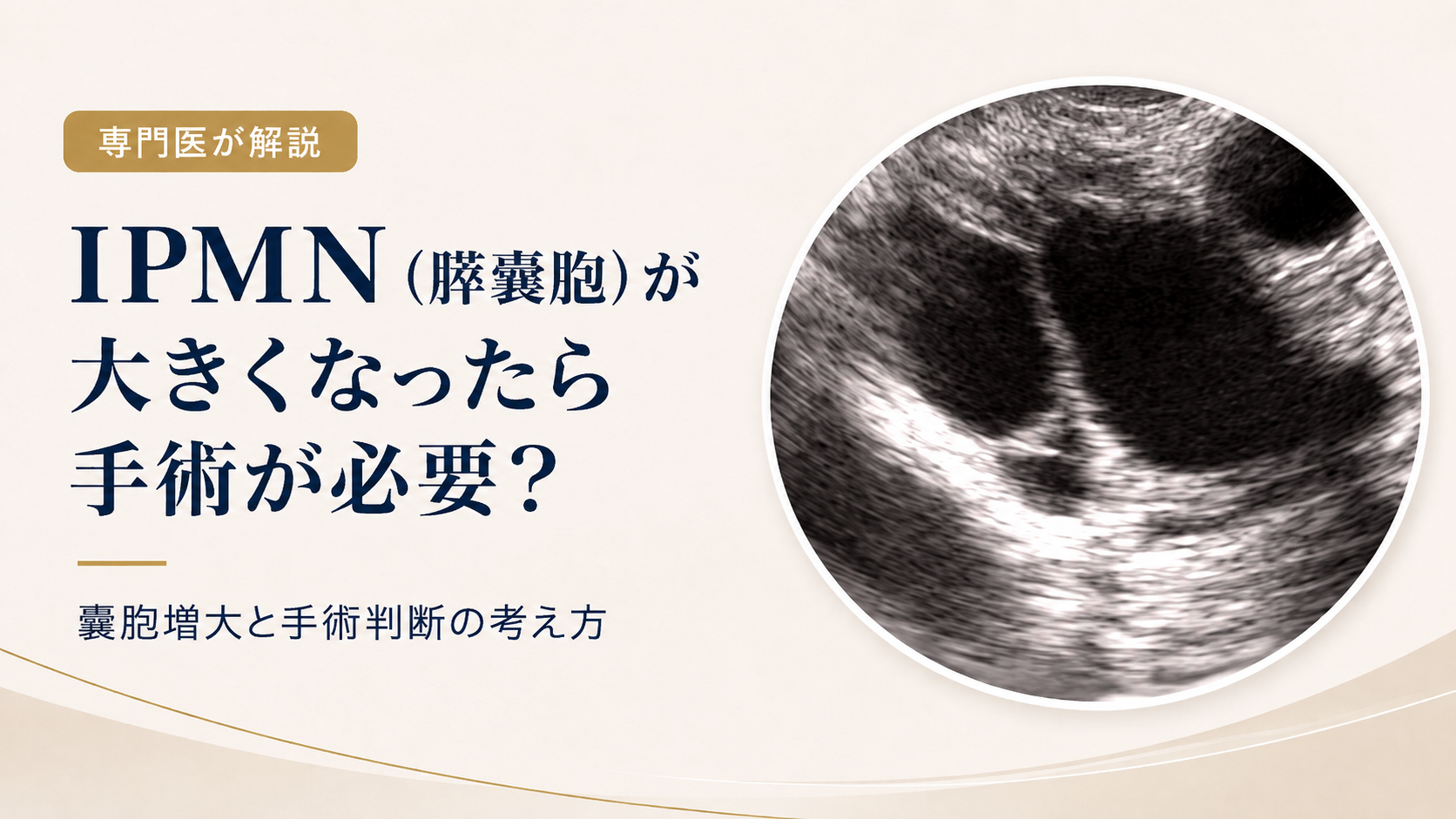 IPMN(膵嚢胞)が大きくなったら手術が必要?